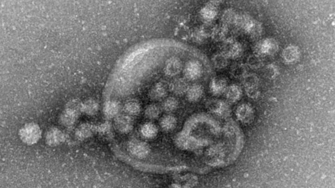 Das Norovirus unter einem Elektronenmikroskop.