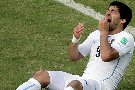 Luis Suarez schmerzt nicht nur der Biss.