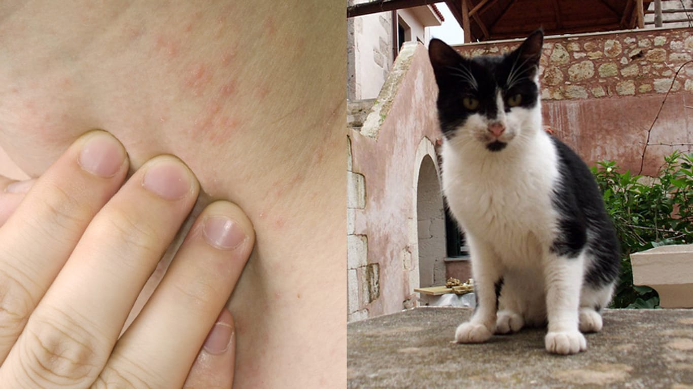 Katzenpilz äußerst sich meist in juckendem Hautausschlag. Wird die Krankheit zu spät erkannt, ist die Behandlung langwierig.