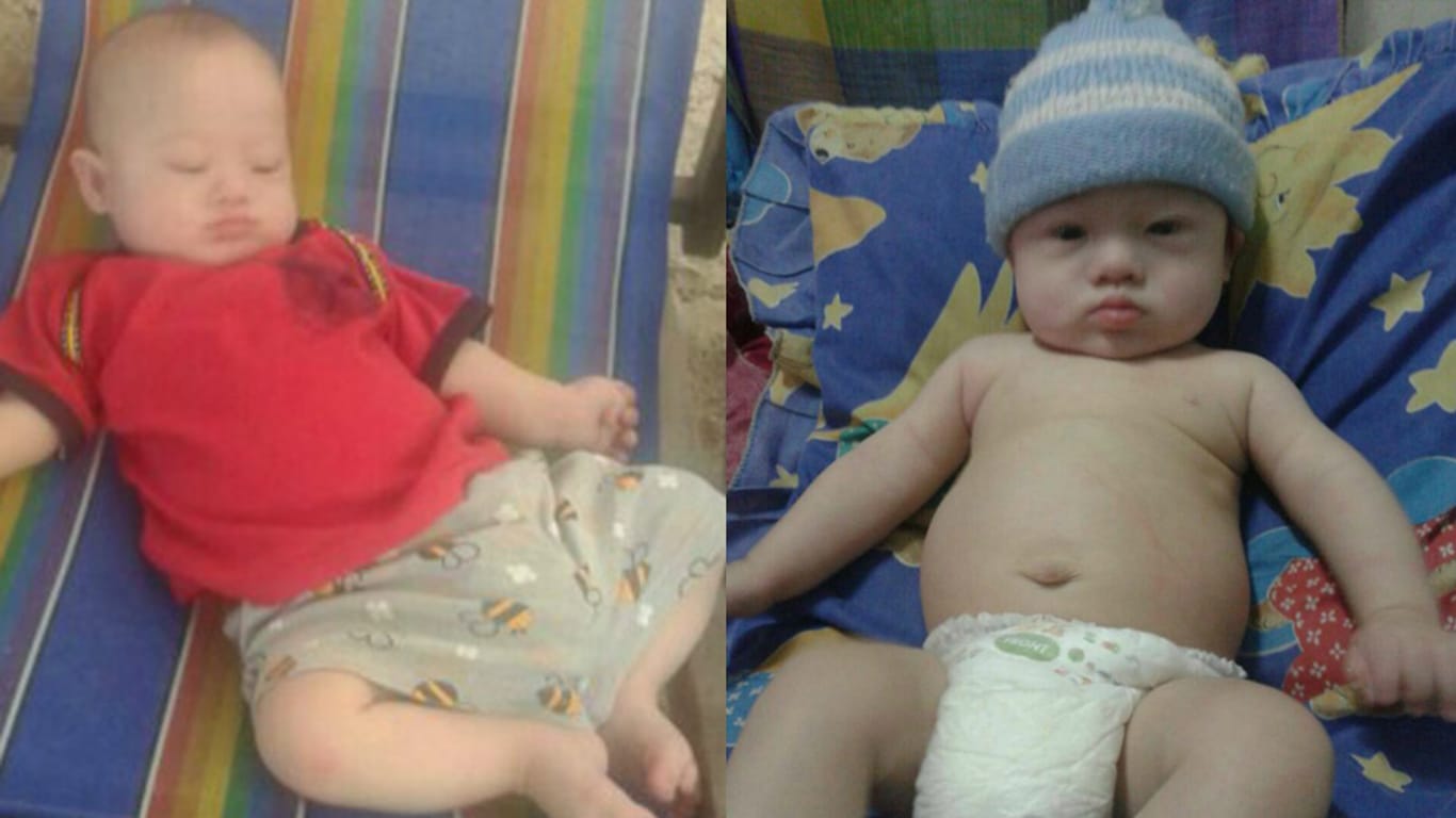 Sitzengelassen: rechts Baby Gammy mit Down-Syndrom; links ihr Schwesterchen, das keinen Gendefekt aufweist