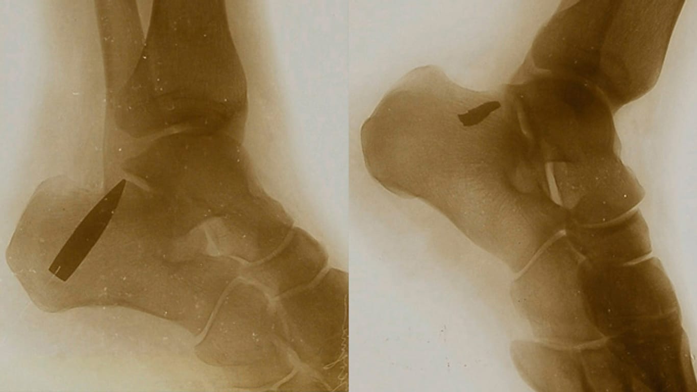 Röntgenbilder boten während des Ersten Weltkrieges Einblicke in den menschlichen Körper, die man vorher nicht kannte.