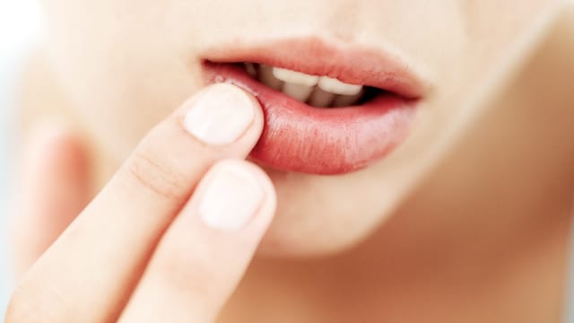 Nehmen Sie mit den Fingern etwas Vaseline auf und verteilen es gleichmäßig auf den Lippen