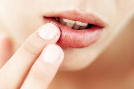 Nehmen Sie mit den Fingern etwas Vaseline auf und verteilen es gleichmäßig auf den Lippen