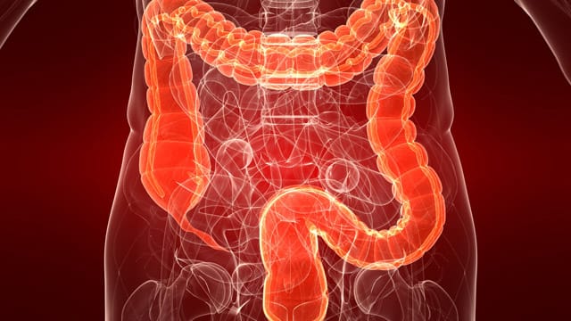 Darmerkrankungen sind manchmal schwer zu diagnostizieren.