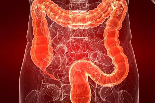 Darmerkrankungen sind manchmal schwer zu diagnostizieren.