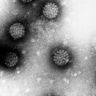 Humane Papillomviren (HPV) unter dem Elektronenmikroskop. Fast jeder Mensch kommt in seinem Leben mit den Viren in Kontakt.