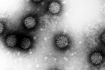 Humane Papillomviren (HPV) unter dem Elektronenmikroskop. Fast jeder Mensch kommt in seinem Leben mit den Viren in Kontakt.