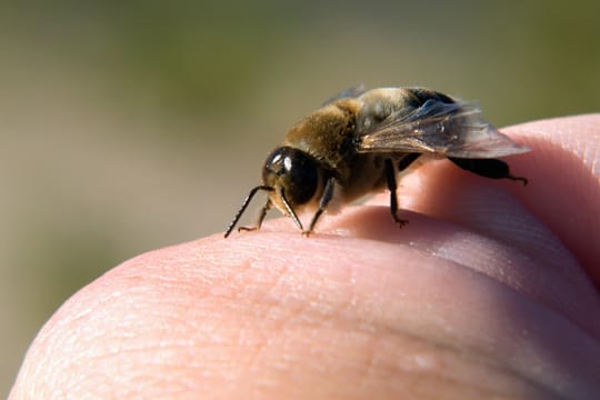 Handeln Sie bei einer Allergie schnell - ziehen Sie den Stachel sofort aus der Haut