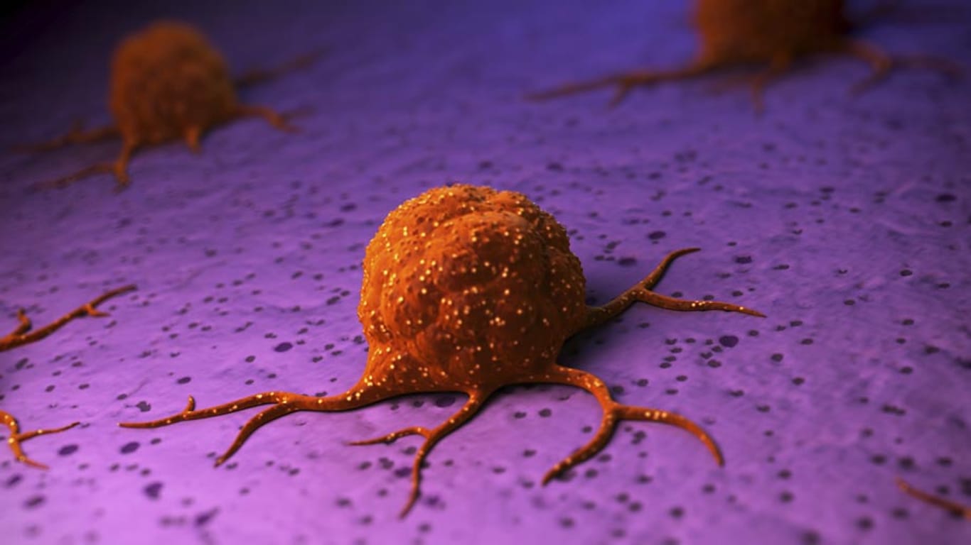 Krebs: Bevor ein Tumor entsteht, durchläuft die Krebszelle drei Stufen.