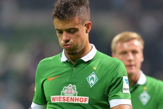 Franco Di Santo fehlt gegen den HSV.