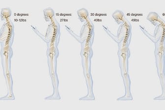 Je tiefer der Kopf geneigt wird, desto mehr Gewicht wirkt auf die Halswirbelsäule.