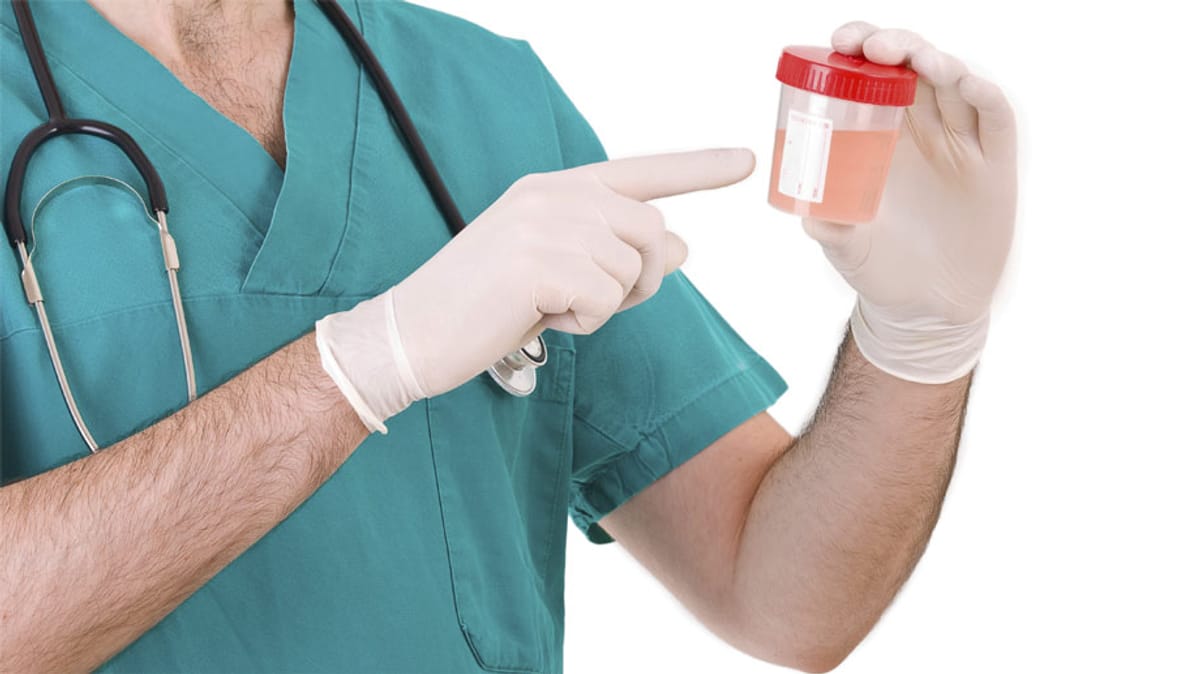 Blut im Urin: Häufigste Ursachen, Symptome und Behandlung