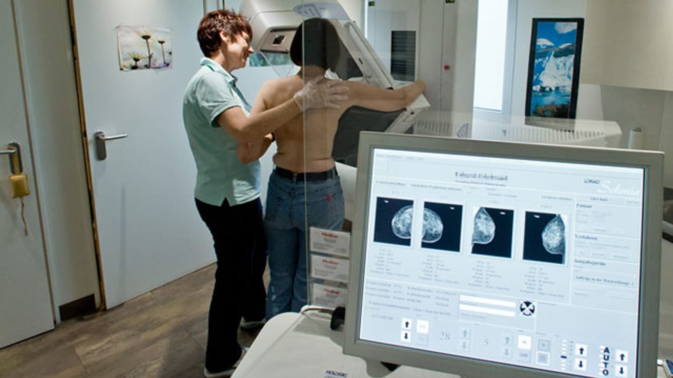 Das Mammografie-Screening wird für Frauen ab 50 empfohlen. Doch die Früherkennungsmethode ist nicht unumstritten.