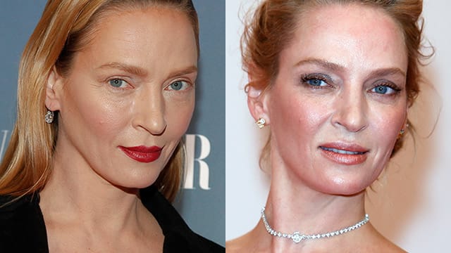 Uma Thurman (li.) nach ihren angeblichen Beauty-Eingriffen und zuvor (re.).