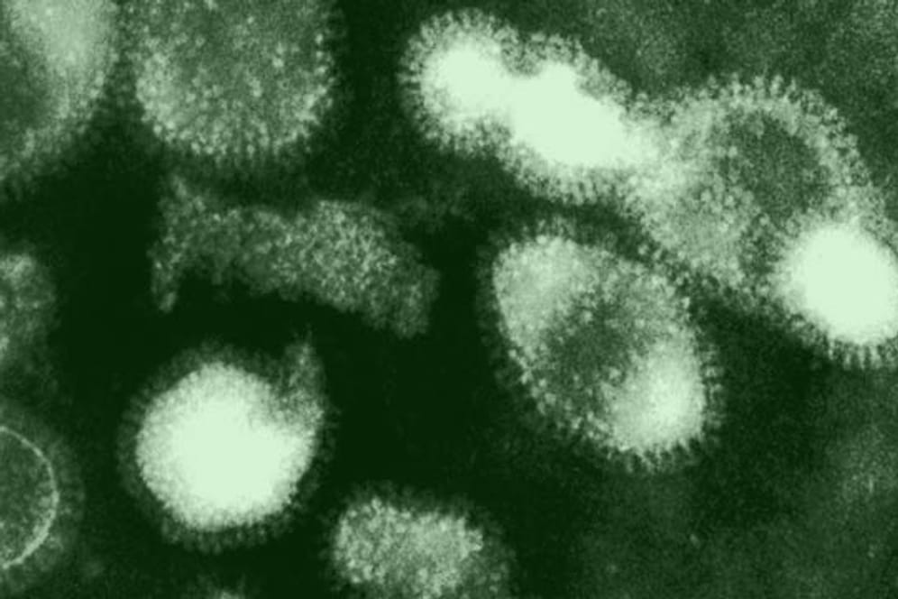 Experten rechnen damit, dass in diesem Winter mehr Menschen an den Folgen einer Grippe sterben.