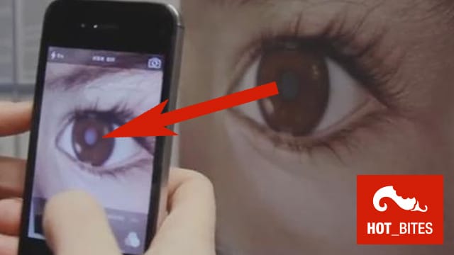 Eine verdächtige Pupillenfarbe kann auf Netzhauttumore bei Kindern hinweisen.