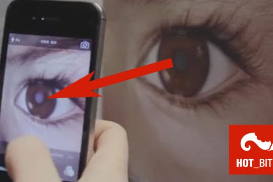 Eine verdächtige Pupillenfarbe kann auf Netzhauttumore bei Kindern hinweisen.
