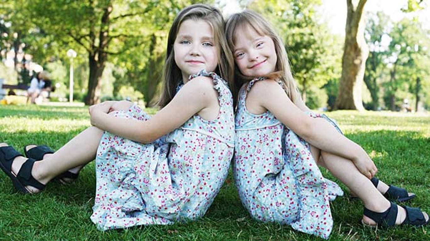 Diskordante Down-Syndrom-Zwillingen: Gleich und doch ganz anders.