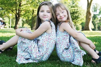 Diskordante Down-Syndrom-Zwillingen: Gleich und doch ganz anders.