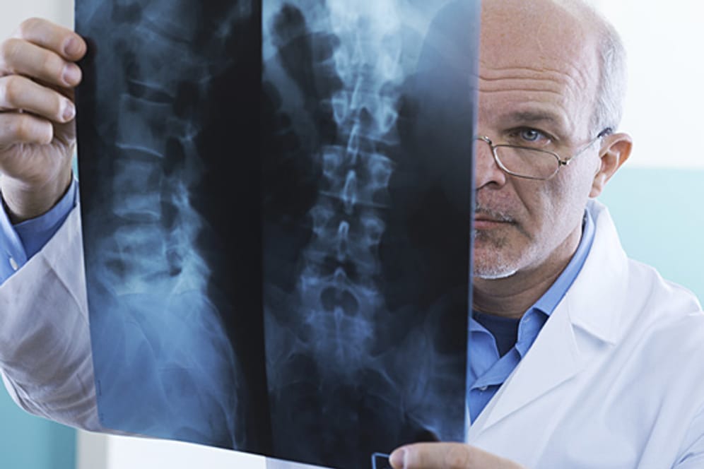 Auf Röntgenbildern ist die Ursache von Kreuzschmerzen oft nicht zu erkennen