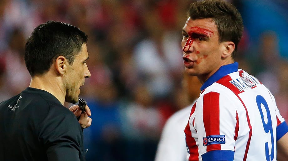 Atletico-Angreifer Mario Mandzukic blutet, nachdem er einen Schlag von Sergio Ramos abbekommen hat.