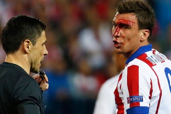 Atletico-Angreifer Mario Mandzukic blutet, nachdem er einen Schlag von Sergio Ramos abbekommen hat.