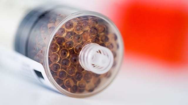 Mit einer kleinen Spritze - die an einem Ende künstlich angereicherte Proteine in Form von Kügelchen enthält - nimmt Wehling den Patienten Blut ab Mit einer kleinen Spritze - die an einem Ende künstlich angereicherte Proteine in Form von Kügelchen enthält - nimmt Wehling den Patienten Blut ab