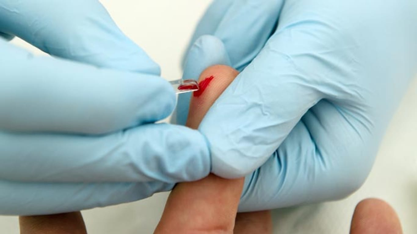 Die Forscher untersuchten für "VirScan" Blutproben von 569 Menschen.