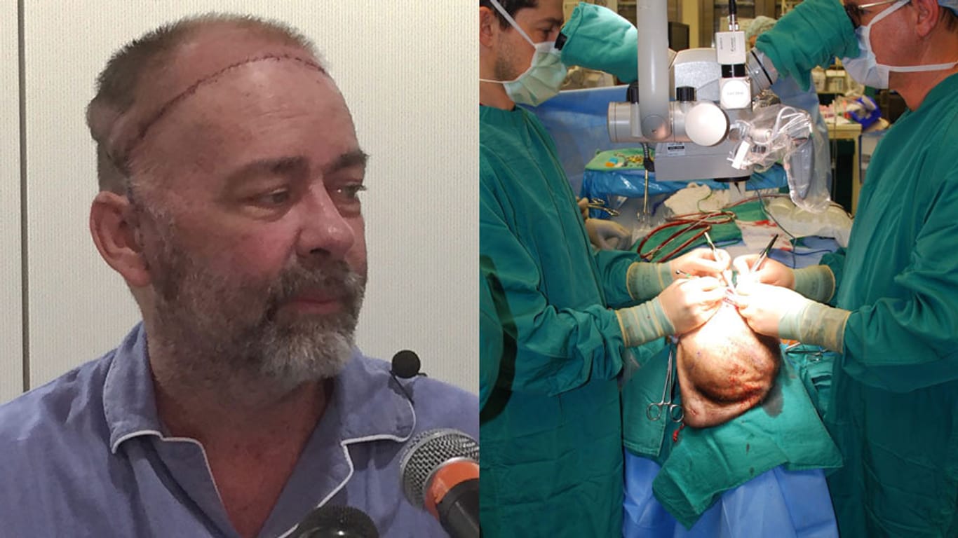 Jim Boysen geht es nach der Schädeldeckentransplantation gut.