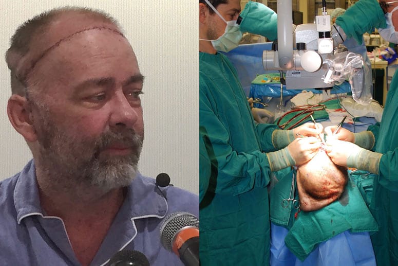 Jim Boysen geht es nach der Schädeldeckentransplantation gut.