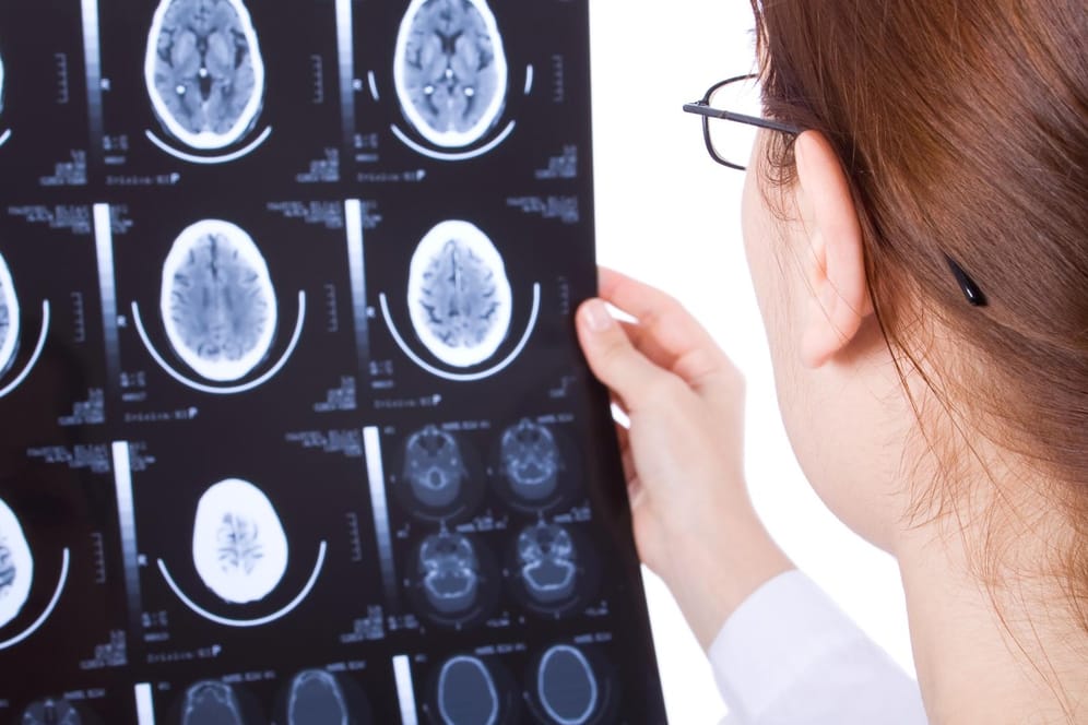 Alzheimer: Ein MRT zeigt für Alzheimer typische Veränderungen im Gehirn. Aber als Früherkennung ist die Untersuchung umstritten.