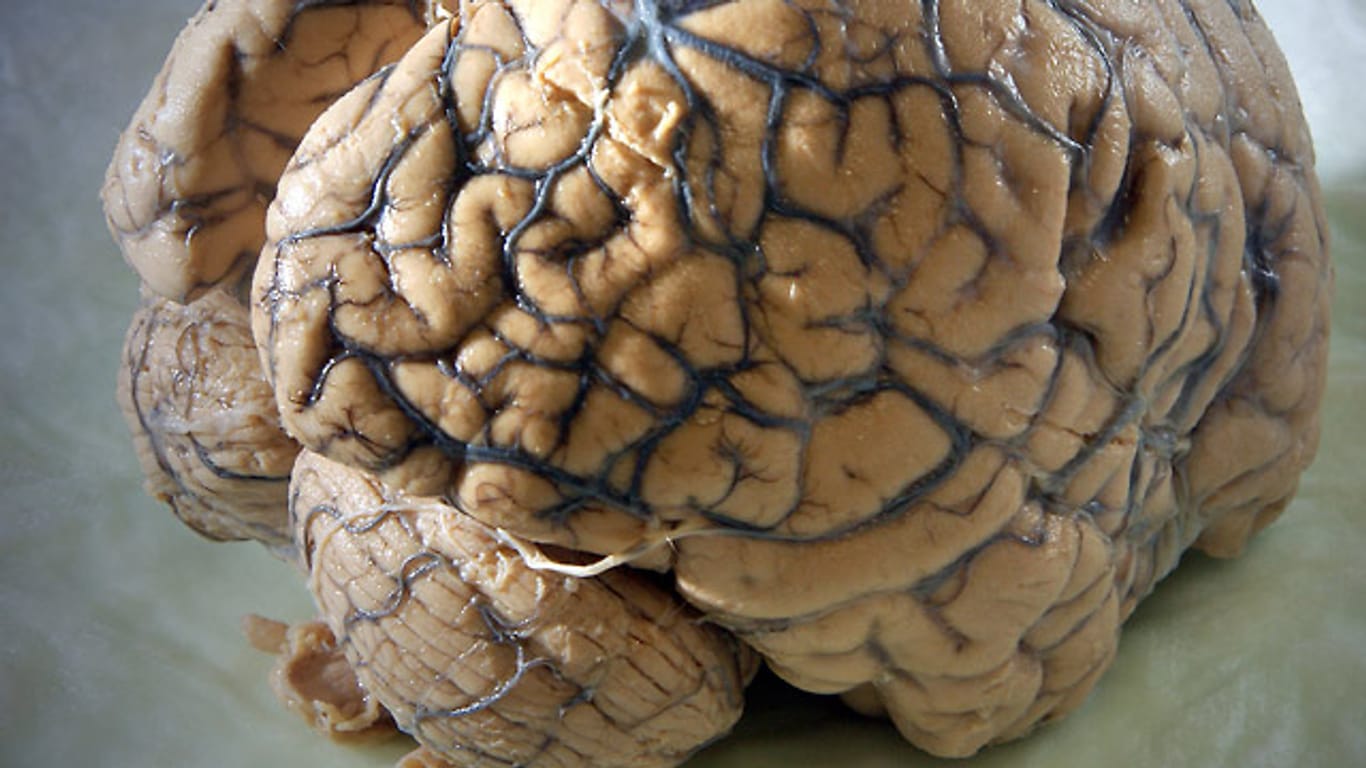 Ein normales menschliches Gehirn. Ein Forscher will jetzt eine erbsengroße Version gezüchtet haben.