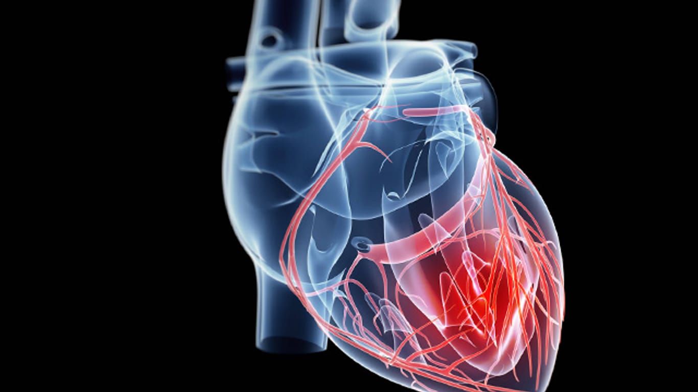 Luftnot und Herzrhythmusstörungen: Bei einer Asiatin werden Knoten am Herzen gefunden.