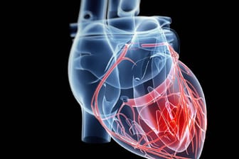 Luftnot und Herzrhythmusstörungen: Bei einer Asiatin werden Knoten am Herzen gefunden.