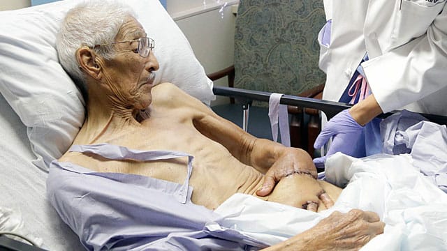 Für den 87-jährigen Frank Reyes war die eingenähte Hand "ein komisches Gefühl".