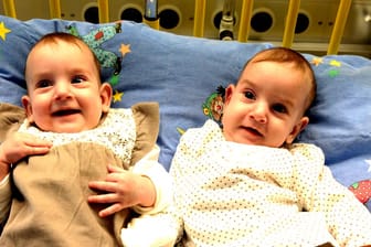 Siamesische Zwillinge: Tamari und Tebrole haben die trennende Operation gut überstanden und dürfen bald die Klinik verlassen.
