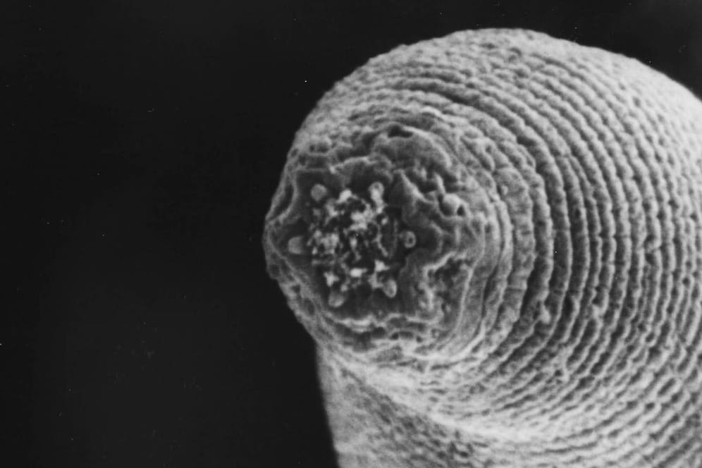 Der Augenwurm Loa loa zählt zu den Fadenwürmern.