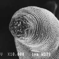 Der Augenwurm Loa loa zählt zu den Fadenwürmern.