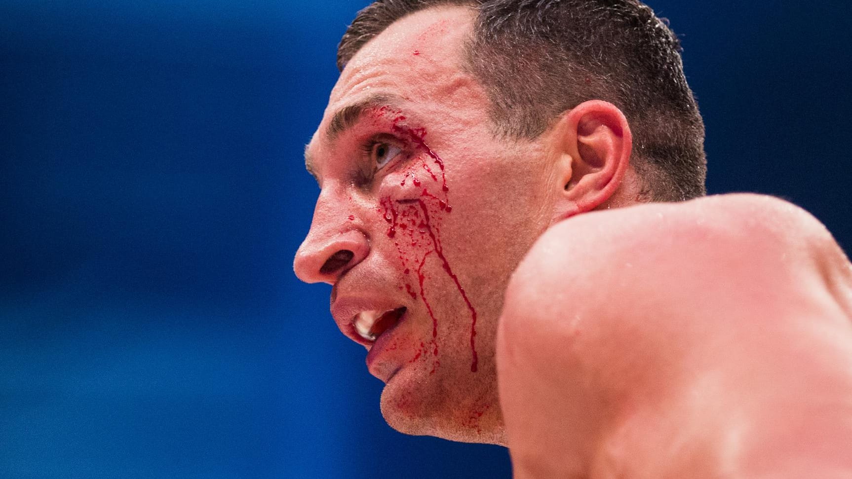 Schwer gezeichnet: Wladimir Klitschko beim Kampf gegen Tyson Fury.