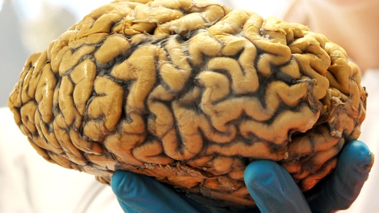 Ein menschliches Gehirn wiegt knapp anderthalb Kilo: das von Männern im Schnitt 1446 Gramm, das von Frauen 1330 Gramm.
