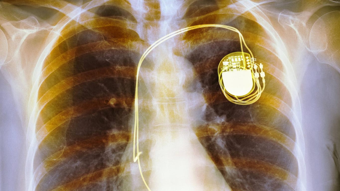 Ein Herzschrittmacher soll Leben retten, Hacker könnten ihn als Mordwerkzeug nutzen.
