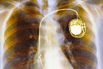 Ein Herzschrittmacher soll Leben retten, Hacker könnten ihn als Mordwerkzeug nutzen.