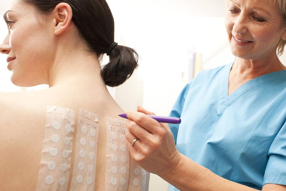 Bei einem Allergietest werden veschiedene verdächtige Substanzen auf der Haut getestet.