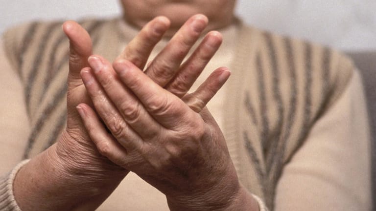 Eine Frau massiert sich die Hände: Bei der Weißfingerkrankheit sind die Gefäße schlecht durchblutet.