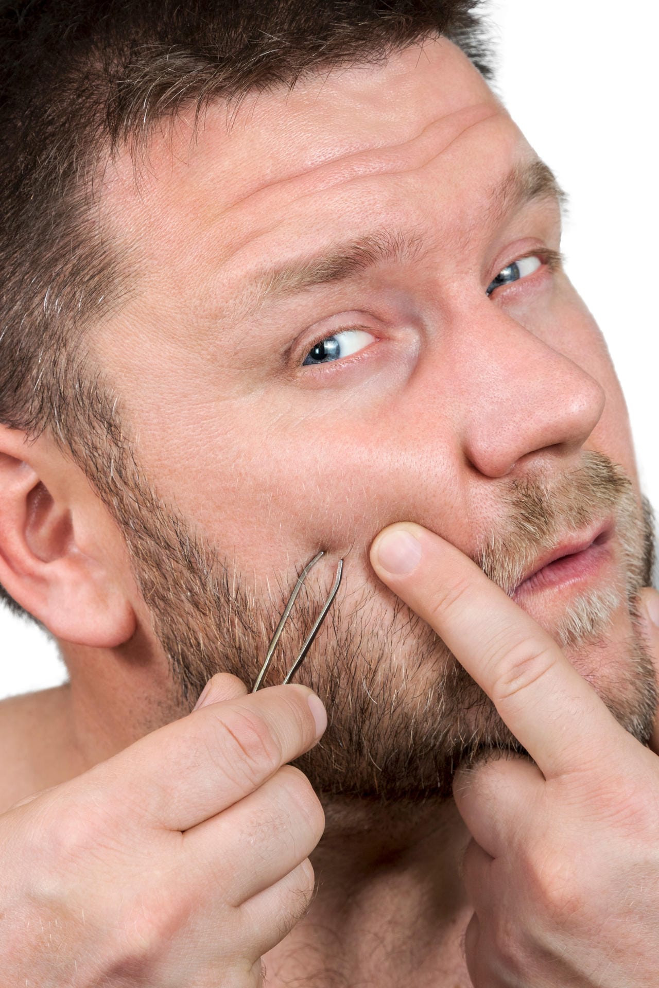 Zum entfernen des eingewachsenen Haars nutzen Sie nur eine desinfizierte Nadel oder Pinzette. Oder fragen Sie den Kosmetiker Ihres Vertrauens.