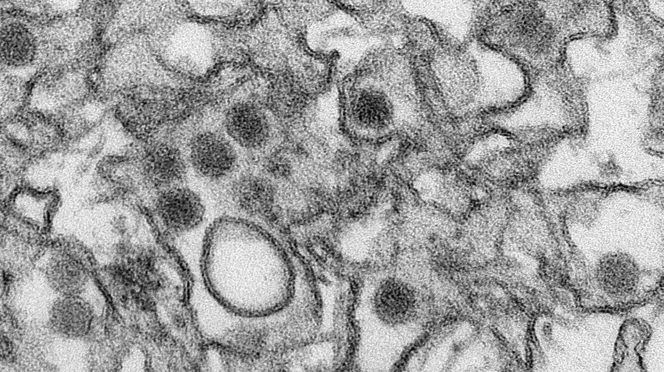 Zika-Virus unter dem Elektronenmikroskop