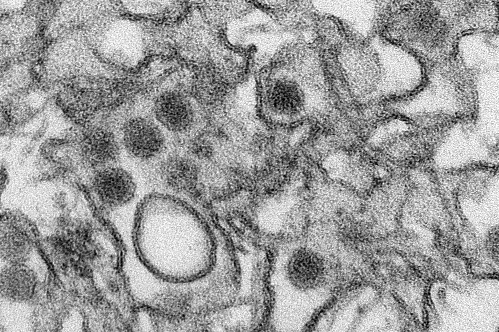 Zika-Virus unter dem Elektronenmikroskop
