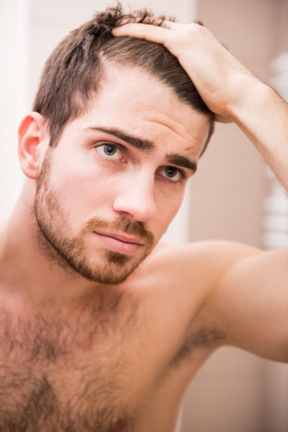 Haarausfall beginnt bei vielen Männern bereits zwischen 20 und 30 Jahren.
