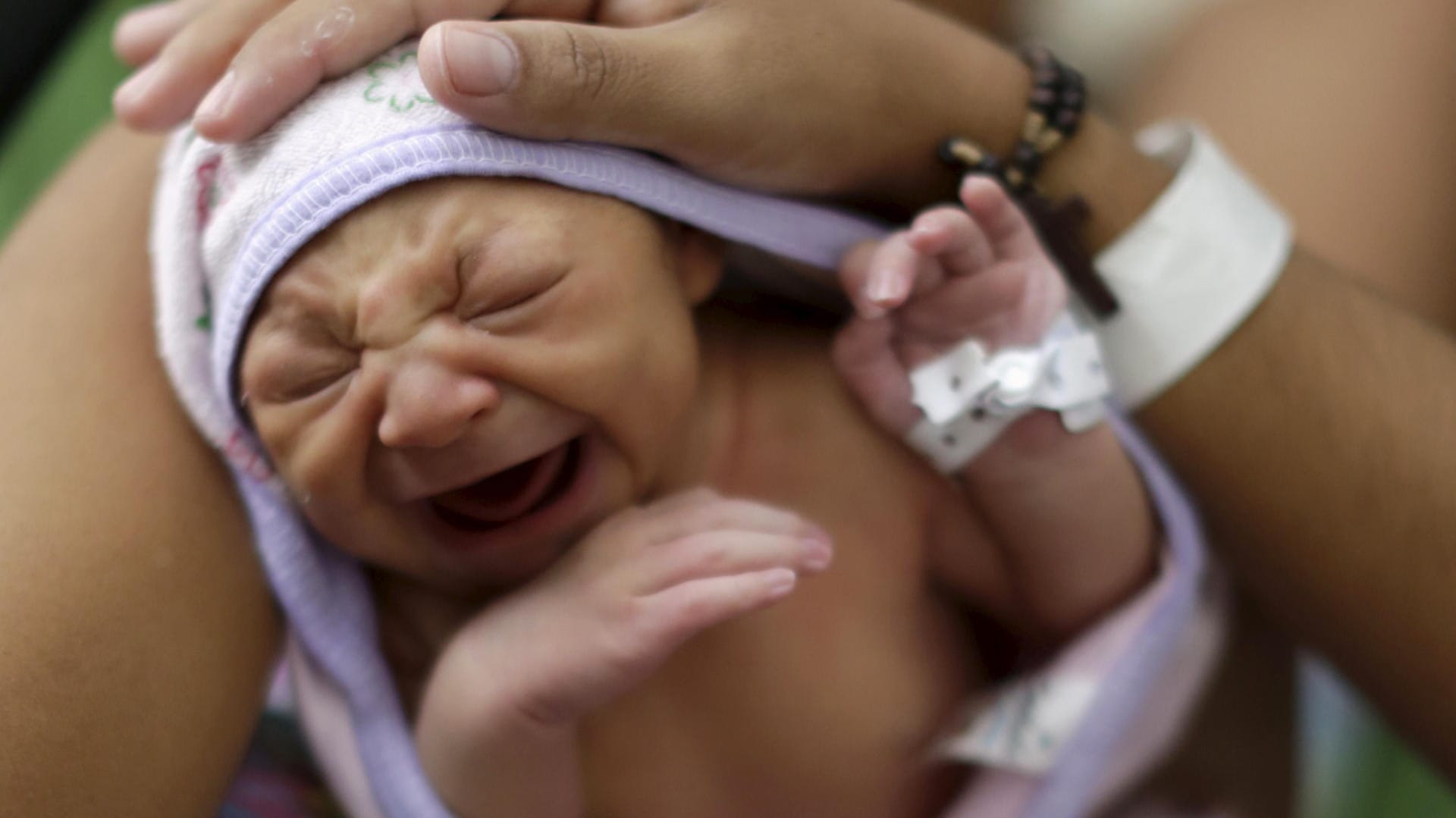 Zika-Virus: Das Baby Milena kam im Januar im brasilainischen Recife mit Mikrozephalie zur Welt.