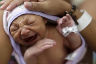Zika-Virus: Das Baby Milena kam im Januar im brasilainischen Recife mit Mikrozephalie zur Welt.